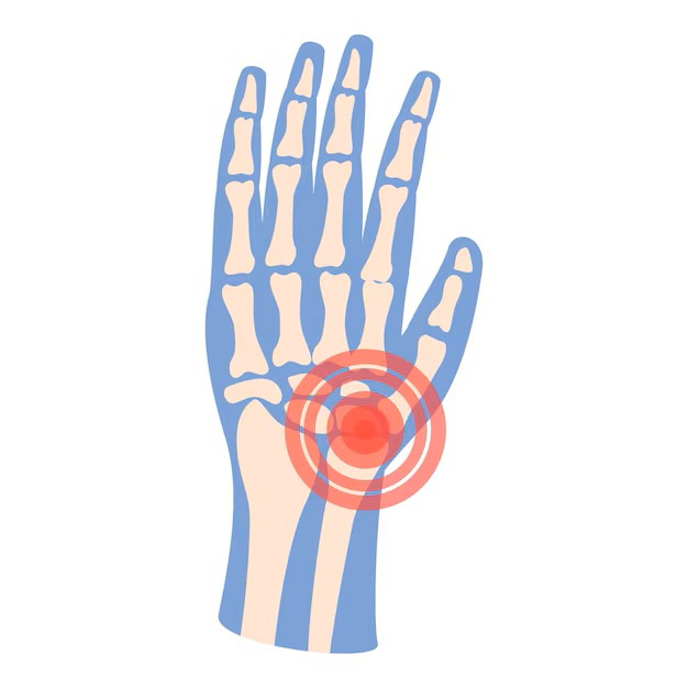 💉 Speed Arthritis Advace profile