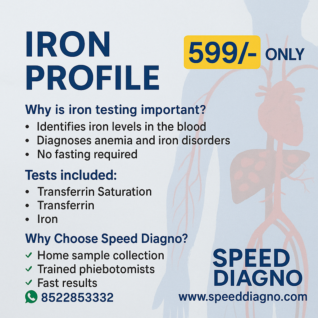 IRON PROFILE