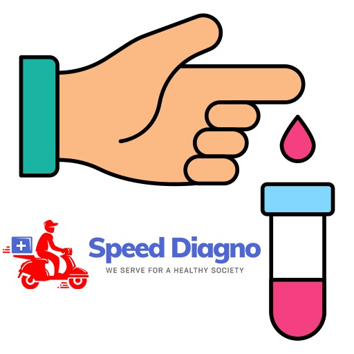 Sex Hormone Binding Globulin (SHBG)