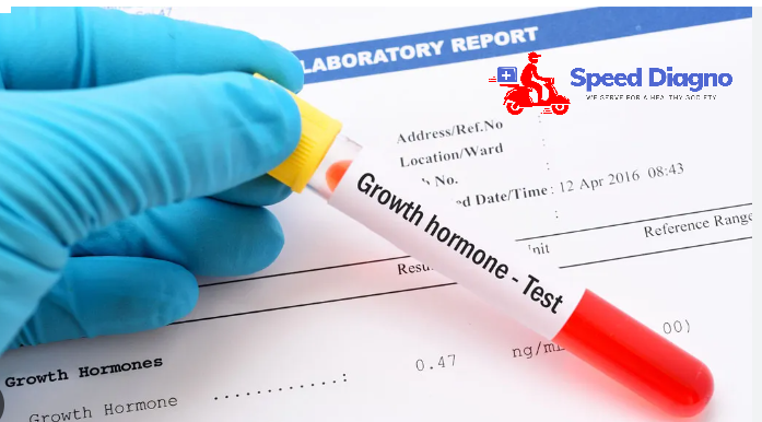 GROWTH HORMONE ( GH )