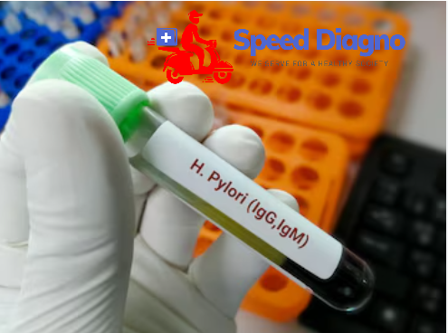 HELICOBACTER PYLORI IGG & IGM ANTIBODY