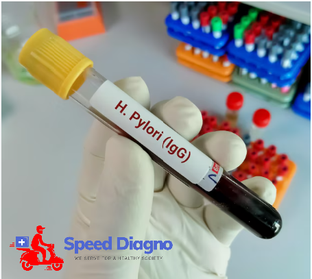 HELICOBACTER PYLORI IgG Antibody