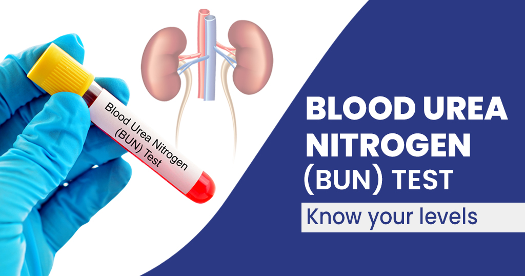BLOOD UREA NITROGEN ( BUN )
