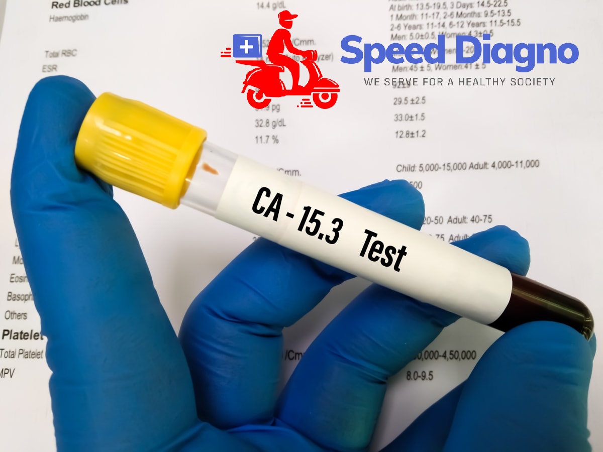 CA 15.3 ( BREAST CANCER MARKER )