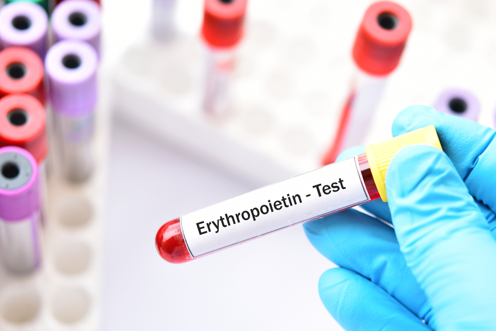 Erythropoietin
