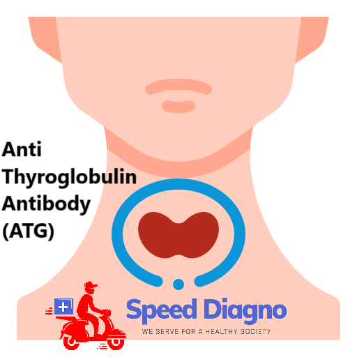 Anti Thyroglobulin Antibody (ATG)