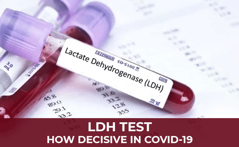 LACTATE DEHYDROGENASE ( LDH )