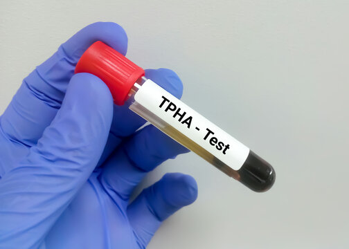 TPHA (Treponema Pallidum Hemagglutination Assay)