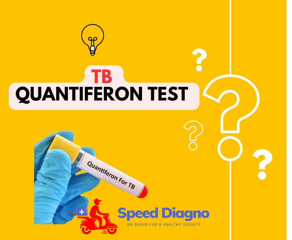 QuantiFERON-TB Gold ( QFT )