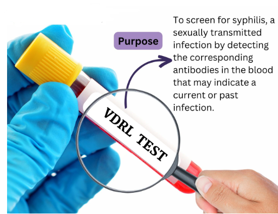 VDRL (Venereal Disease Research Laboratory)