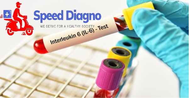 INTERLEUKIN-6 (IL-6)