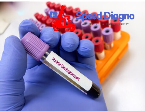 PROTEIN ELECTROPHORESIS