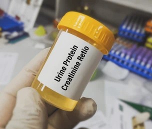 URINE PROTEIN & CREATININE RATIO