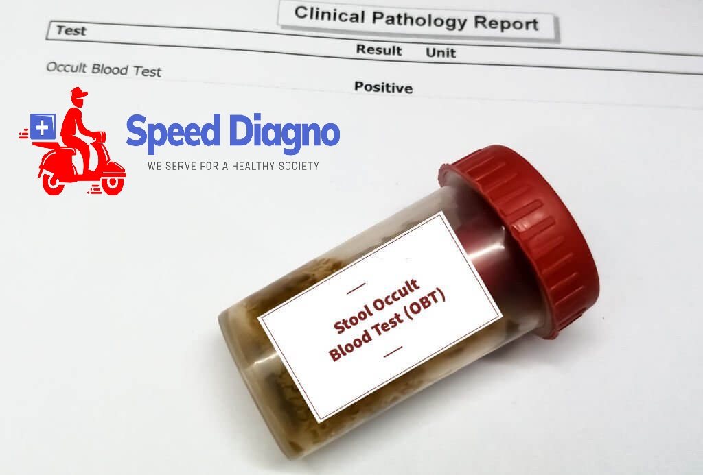 STOOL FOR OCCULT BLOOD