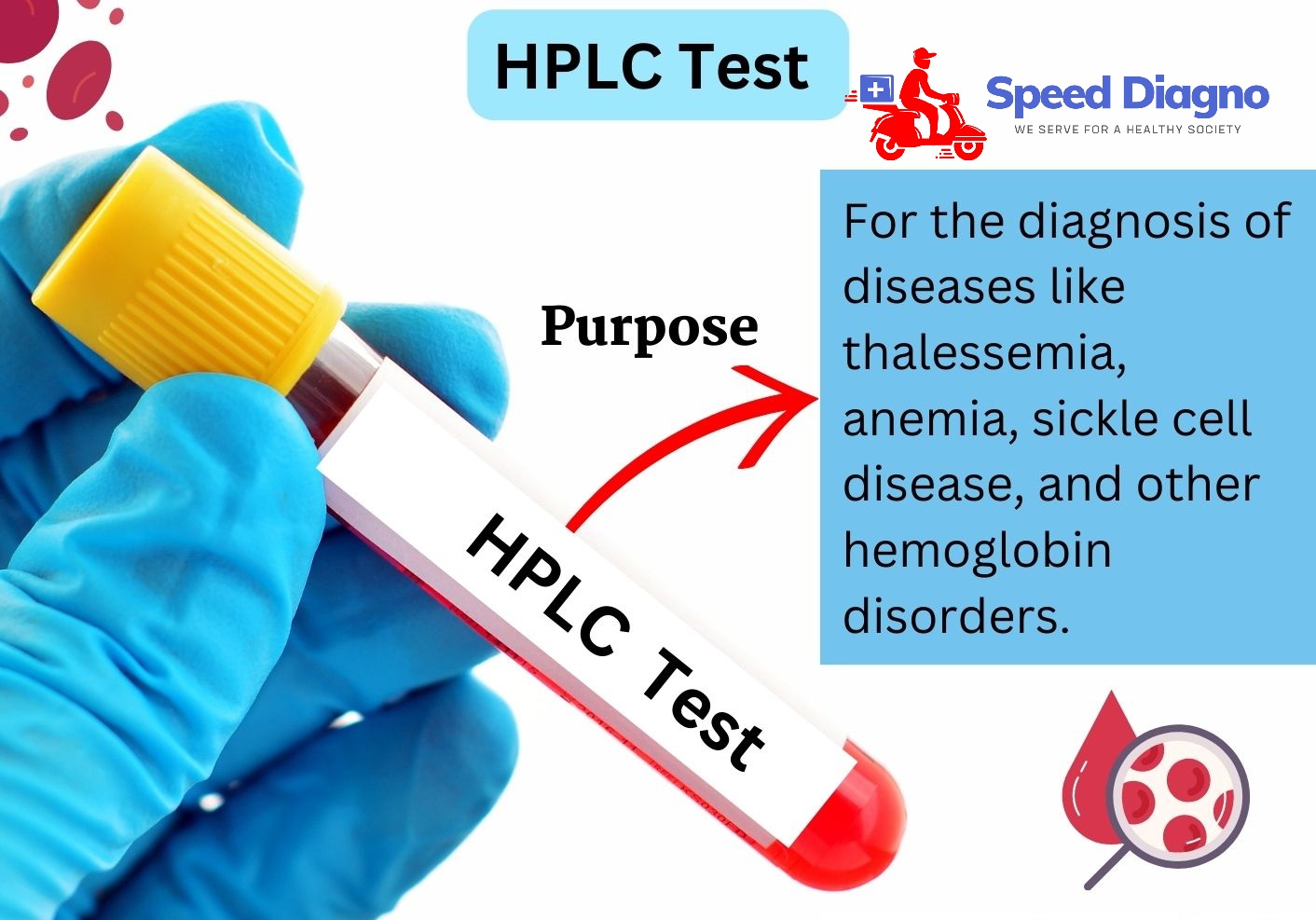 Hemoglobinopathy by HPLC (Hb electrophoresis)