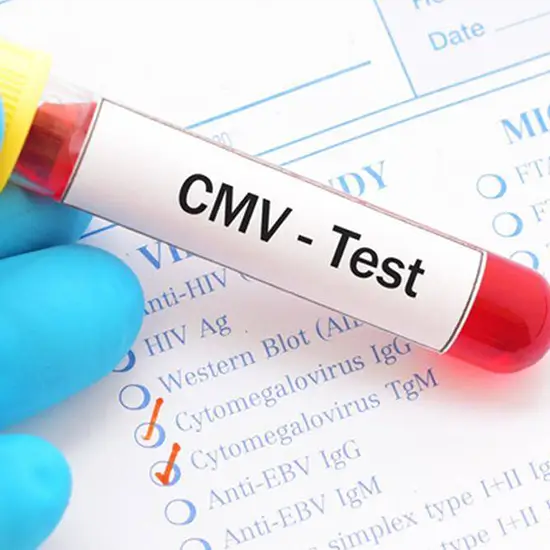 Cytomegalovirus (CMV) Antibody-IgM