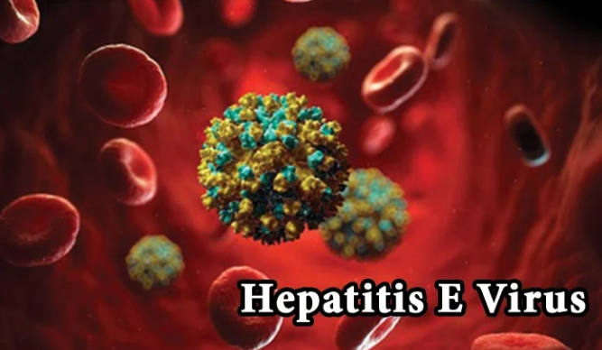 Hepatitis E virus - IgM (HEV IgM)