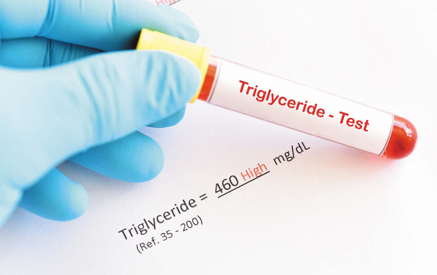 TRIGLYCERIDES (TGL)