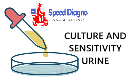 CULTURE AND SENSITIVITY URINE