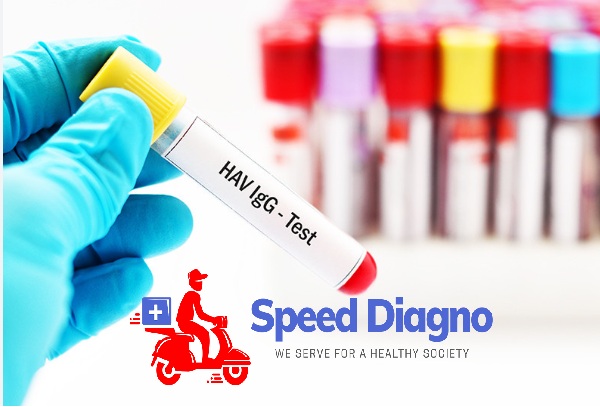 HEPATITIS A VIRUS - IgG ( HAV - IgG )