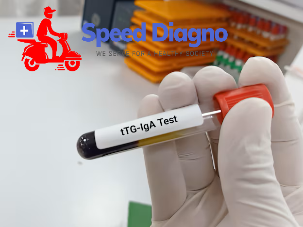 TISSUE TRANSGLUTAMINASE - IgA ( TTGA )