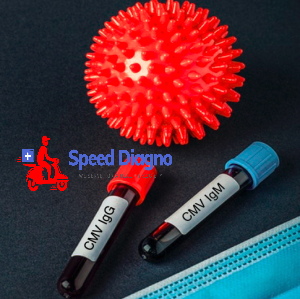 CYTOMEGALOVIRUS ANTIBODIES - IgG