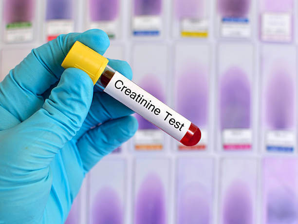 CREATININE