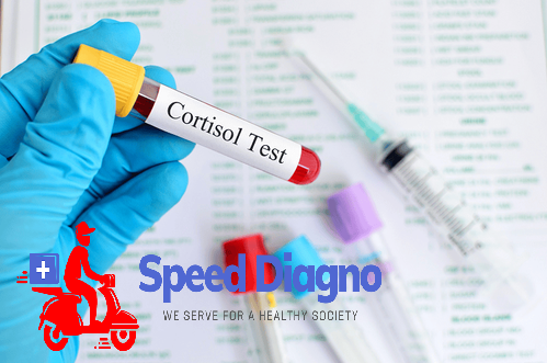 Cortisol Serum (3 to 5 PM)