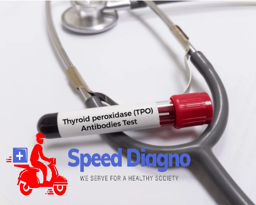 ANTI THYROID PEROXIDASE (TPO/AMA)