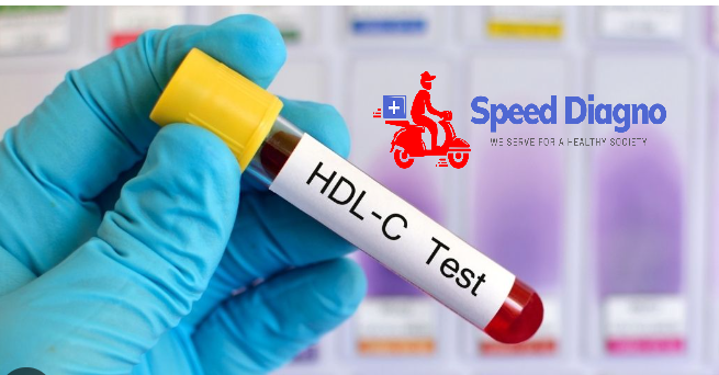 HDL Cholesterol