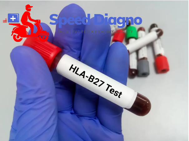 HLA B27 PCR QUALITATIVE