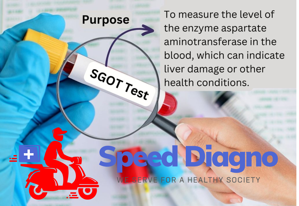 SGOT/AST (ASPARTATE TRANSAMINASE)