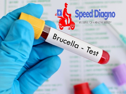 BRUCELLA ANTIBODY IgG