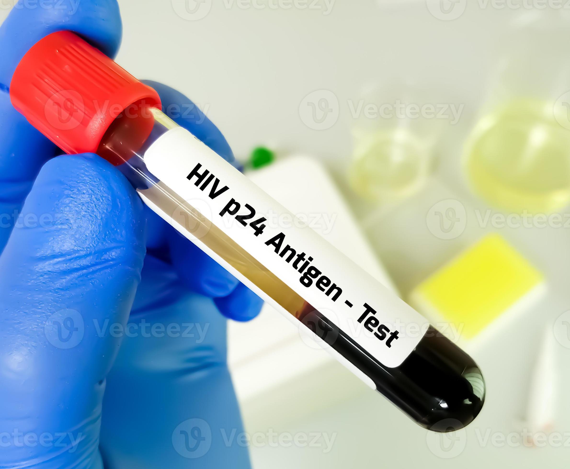 HIV p24 Antigen Detection