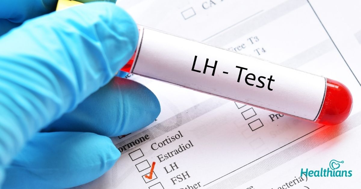 LUTEINISING HORMONE (LH)