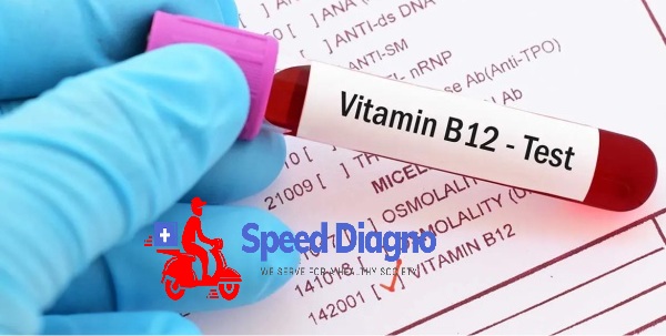 VITAMIN B12