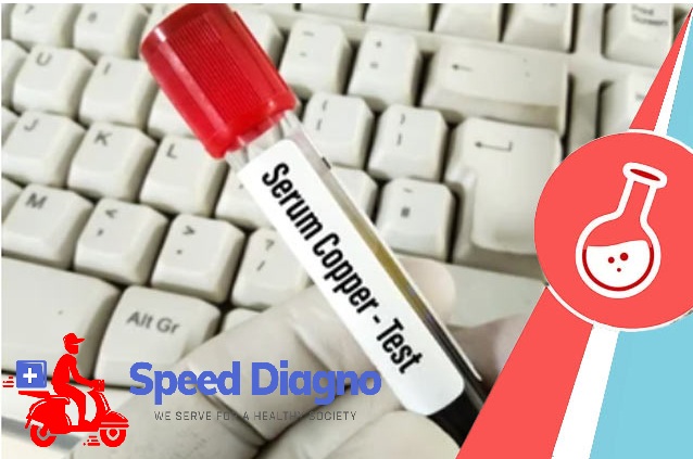 Serum Copper