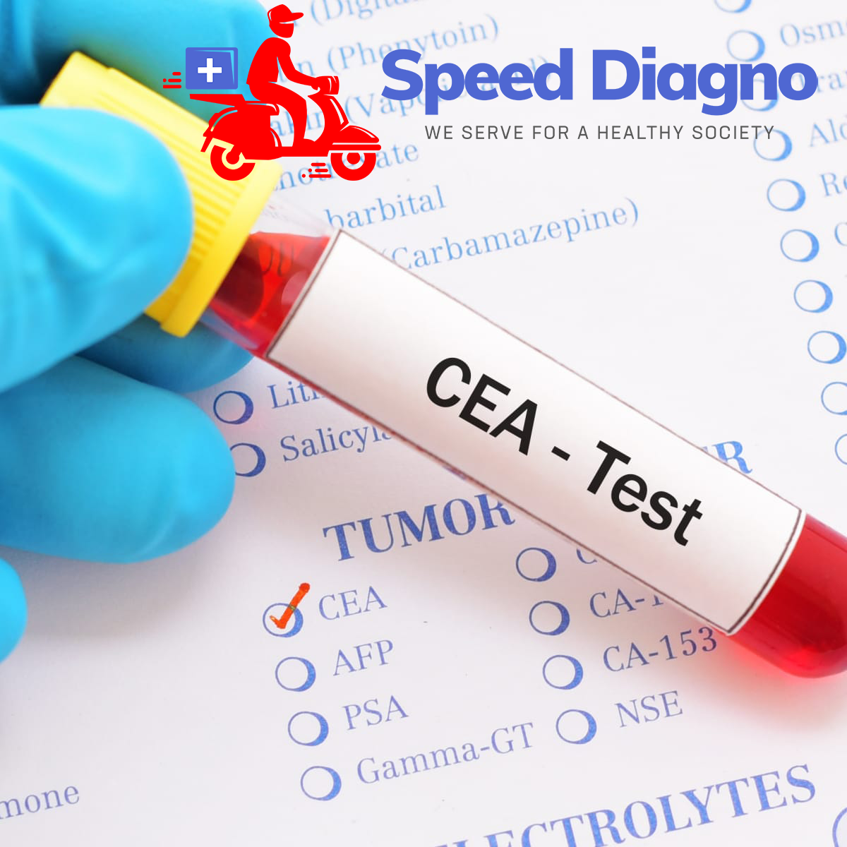 CARCINO EMBRYONIC ANTIGEN ( CEA )