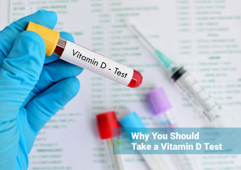 25-Hydroxy Vitamin D