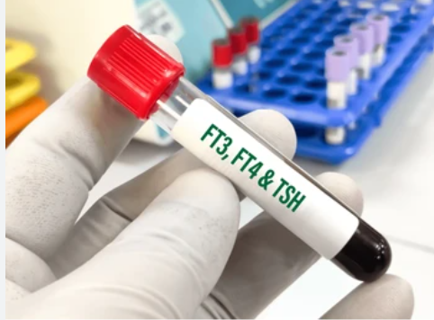 FREE THYROID FUNCTION TEST
