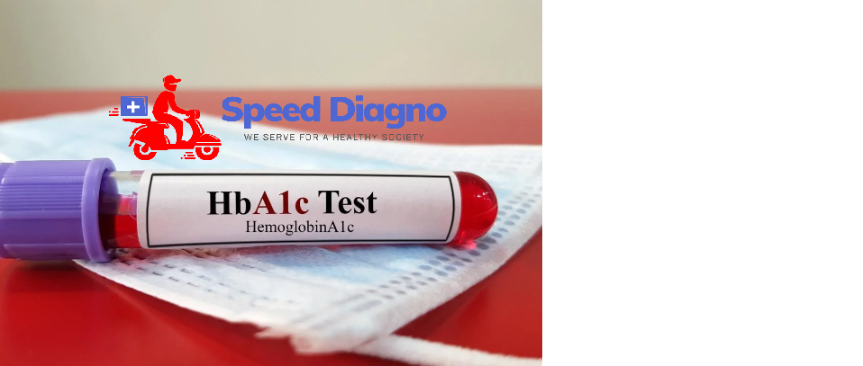 GLYCOSYLATED HAEMOGLOBIN (GHB / HBA1c)
