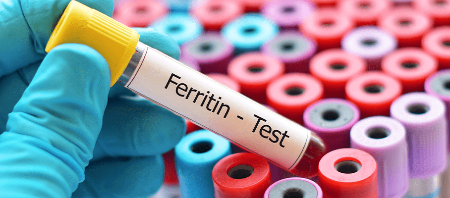 SERUM FERRITIN