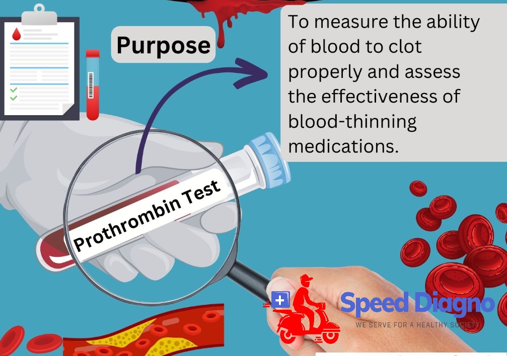 PROTHROMBIN TIME ( PT INR )
