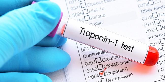 TROPONIN T - QUANTITATIVE