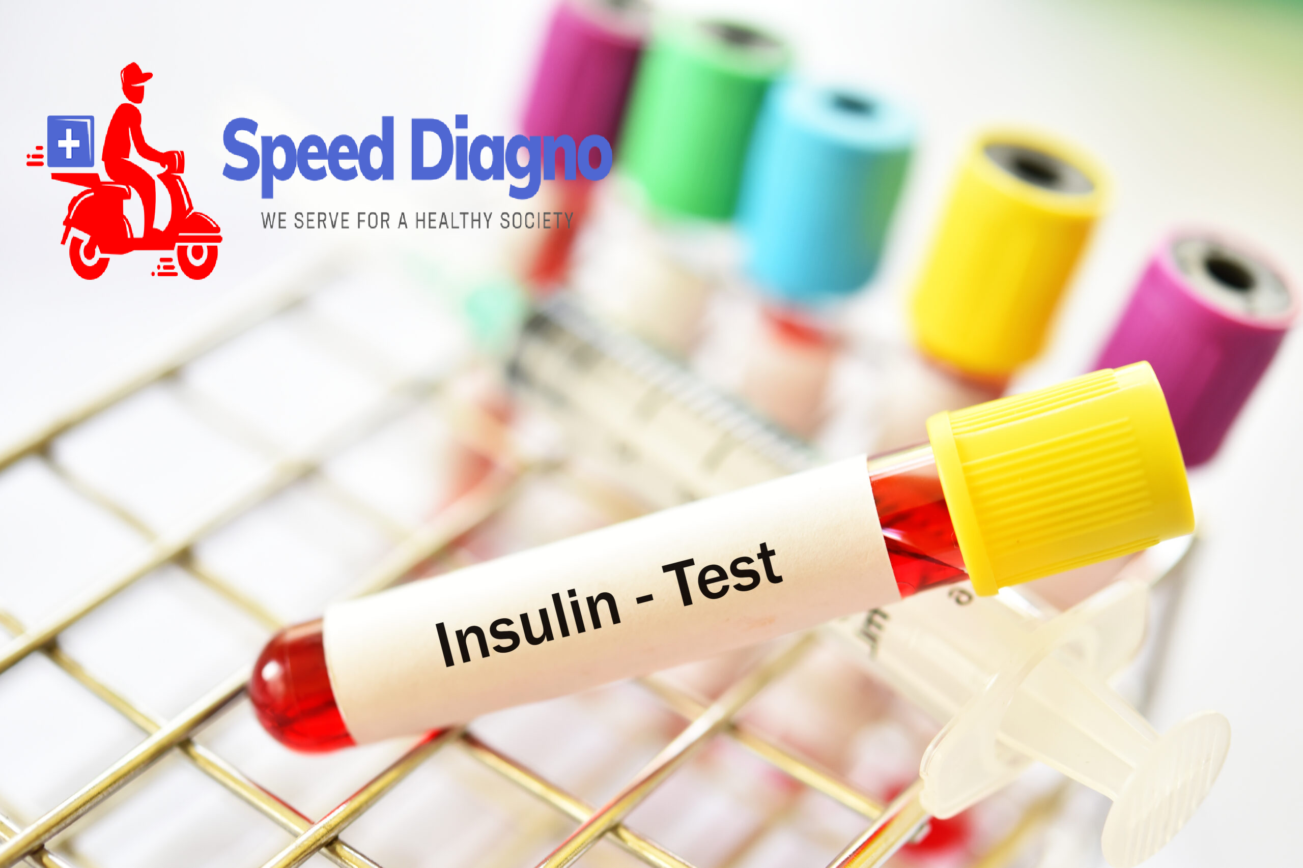 INSULIN LEVEL ( FASTING )