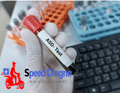 ANTI STREPTOLISIN O ( ASO )