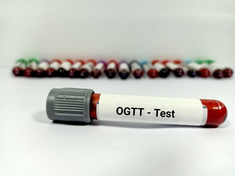 ORAL GLUCOSE TOLERANCE TEST (OGTT) 100 GMS