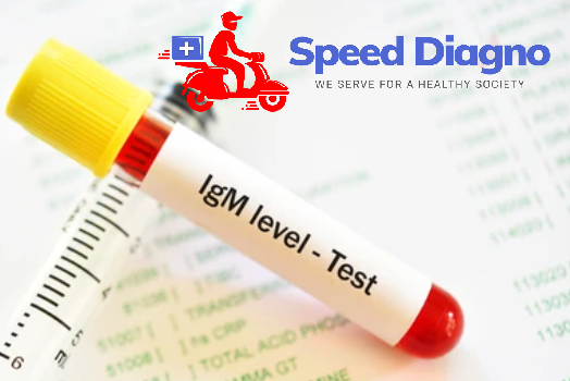 IGM - IMMUNOGLOBULIN M (IGM)