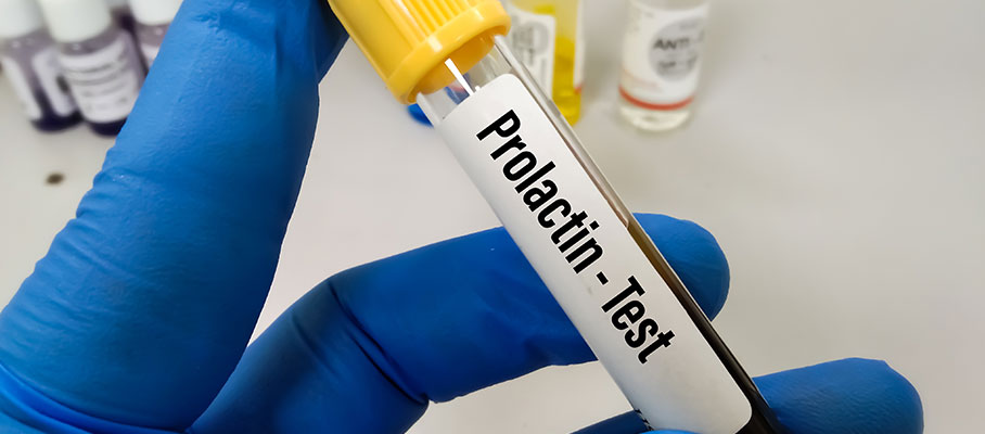 PROLACTIN ( PRL )