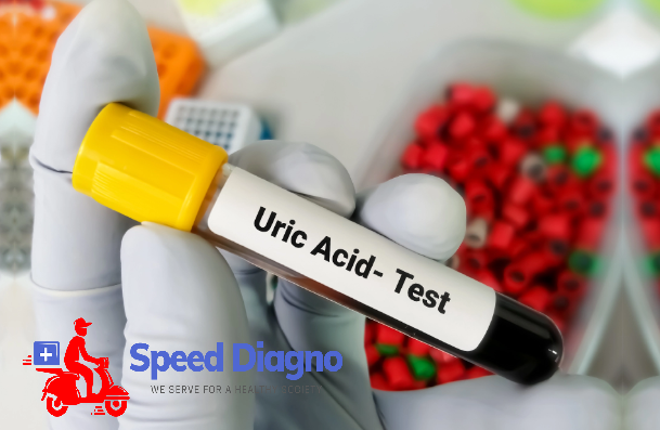 Uric Acid